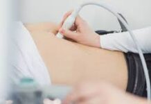 U NEDELJU NOVI KRUG BESPLATNIH PREGLEDA