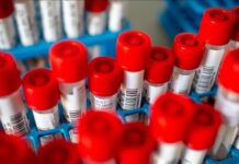 KLADOVO KORONA PODACI 3.SEPTEMBAR