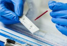 BLAGI PORAST BROJA INFICIRANIH VIRUSOM KORONA